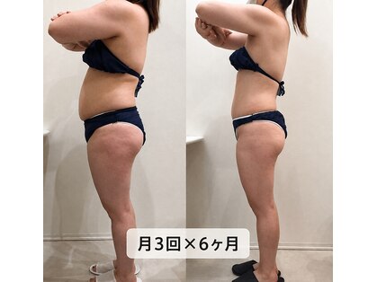ミール(Meel)の写真
