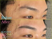 エムディラボ 金沢竪町店(MDラボ)/BeforeAfter