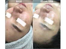 アイアール(ir)/