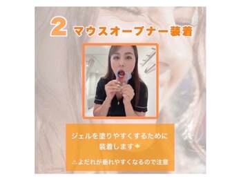 ホワイトニングショップ 越谷店/【ステップ2】