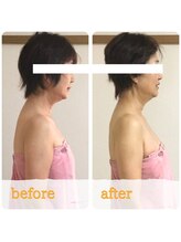 ティアラ/before after　[デトリム]