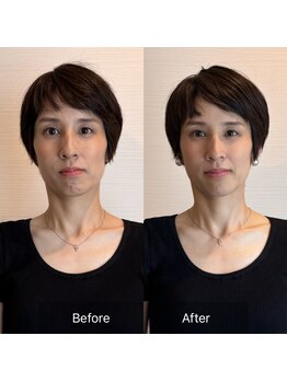 トータルボディケアサロン松濤/ビフォーアフター