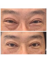 ビハダ(BeHADA)/毛穴/シミしわ改善/小顔/引締