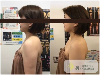 美プレミアム 川越店/360°美顔小顔矯正｜施術結果