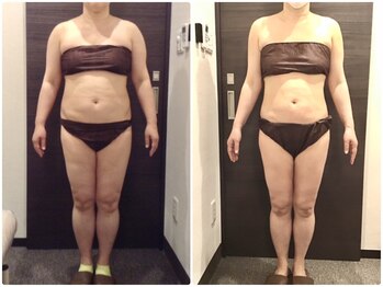 美容整体ウェリナ 名駅院/小顔矯正/骨盤矯正/美脚サロン