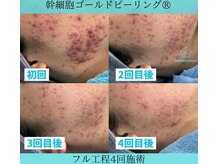 リメイククリニカルビューティー(Remake clinical beauty)/