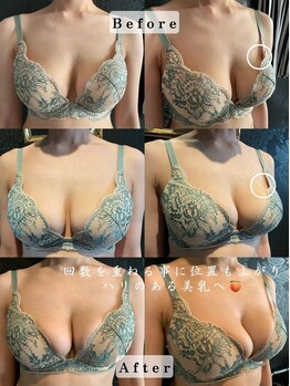 エステティックサロン パヒューム(Esthetic Salon Perfume)/自分史上最高のバストへ