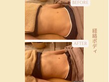 エイミー(Aimee)/【経絡リンパ】ビフォーアフター