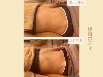 エイミー(Aimee)/【経絡リンパ】ビフォーアフター