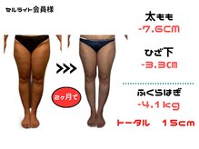 ビューティースリム リボーン 銀座店(reborn)/脚全体のラインが変化