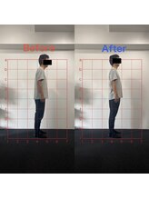 グラスルーツ 靭公園(Grass-Roots)&nbsp;猫背が改善 姿勢が変化