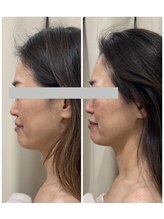 メディカルエース(MedicalAce)/【最強引き上げ×透明美肌】