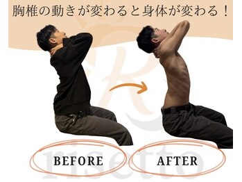 リセット鍼灸院(Risetto鍼灸院)/胸椎は身体の連動のカギ!