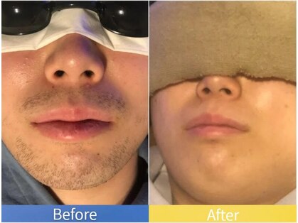 リエール(Le:YELL)の写真