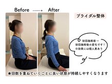 ルリアン骨盤小顔整体院 横浜/before/after