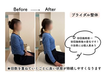 ルリアン骨盤小顔整体院 横浜/before/after