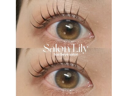 リリー(Lily)の写真