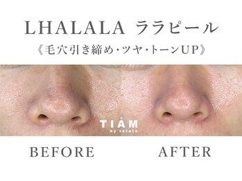 ティアム バイ テトテ 神戸三宮(TIAM by tetote)/ LHALALA ララピール