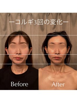 アイミーボーテ(Aime beaute)/《口コミで話題!》No.1コルギ