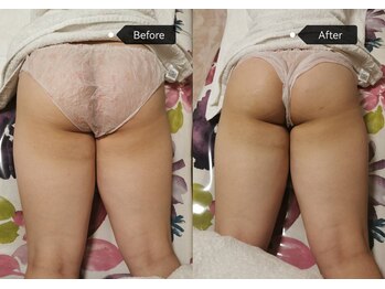 シークレット(Secret)/美尻美脚