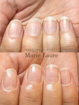 マリーロール 梅田店(Marie Laure)/深爪矯正/自爪育成/自爪風