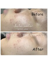 ルルマル(lulumalu)/レストセルトリートメント