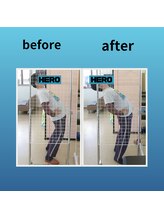 ストレッチヒーロー 米子店/ストレッチでの変化「後屈」