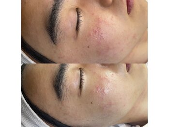 ルームエイトエイティスリー 新宿(R883)/セラピール　before→after