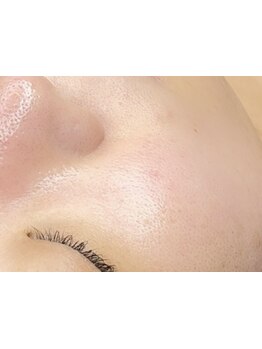 ハリツヤをUPしたい