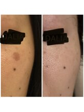 ダリア(DALIA)/エンビロンでシミのないお肌へ♪