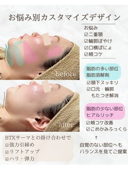 小顔・たるみ・美肌ケア専門 PONOTY clinical salon【3月中旬 NEW OPEN(予定)】/高周波×脂肪コントロール