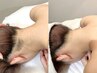 後ろ姿に自信を【うなじ＋背中上部 脱毛】¥7,700→¥3,300