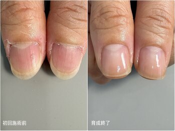 地爪育成
