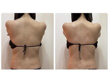 ハピネス(Hapiness)の雰囲気（肩・背中の左右差もチェックしながら全身ケア！ブライダルにも◎）