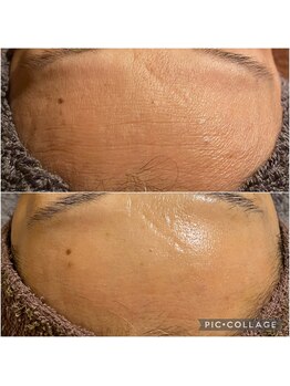 ラクシュミー ナチュラル(Laksmy NATURAL)/お客様ビフォーアフター