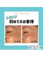 プルミエプラス 恵比寿店(PREMiER+)/【恵比寿/渋谷/シミケア】