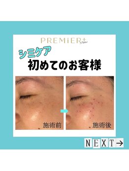 プルミエプラス 恵比寿店(PREMiER+)/【恵比寿/渋谷/シミケア】