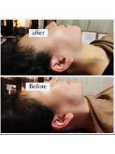 ベリー(Berry)/お悩み解消☆結果重視