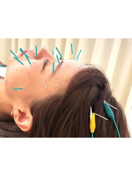 鍼灸施術を受けたい