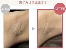 スリリアン 銀座/★お客さまビフォーアフター★