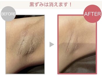 スリリアン 銀座/★お客さまビフォーアフター★