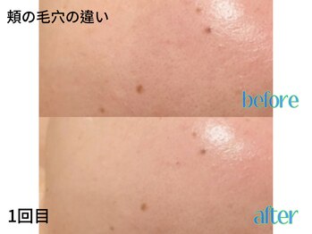 リボーン(be reborn)/透明感アップ!!!