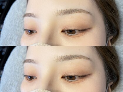 デイアンドナイトアイ 天神大名店(Day&Night Eye)の写真