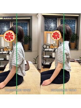 グレフル鍼灸接骨院 整体院 心斎橋/整体/肩こり/マッサージ/腰痛