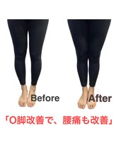 【医療提携】首肩こり・腰痛整体・マシンピラティスASABA整体院/新松戸店/O脚改善★結果写真