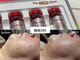 ディアーム 光明池店(Diarm)の写真/憧れの二の腕・ハミ肉へ！脂肪分解美容液でスッキリ引き締め◎レッドショット体験♪