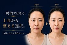 サロン ド ナース ユー ソナ(salon de nurse U.sona)