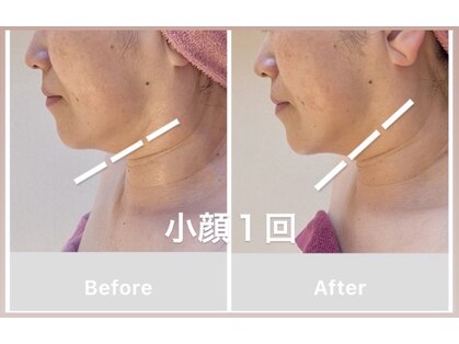 ビジュー(bijou)の写真