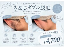 サリエ(S'allier)の雰囲気(人気No.2の『うなじダブル脱毛』女性らしさがよりアップ↑↑)