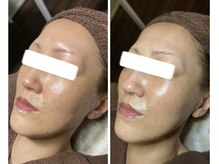 トイボーテ(toi beaute)/むくみスッキリ！艶々素肌！